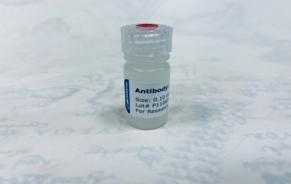 Antibody